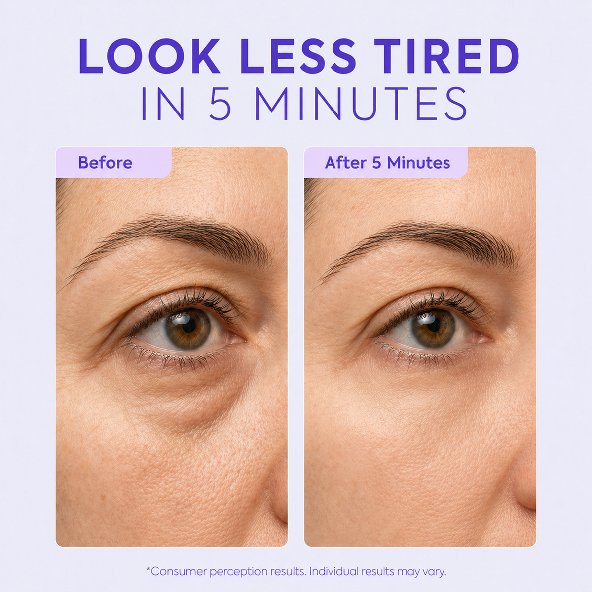 Instant Lift Eye Gel – Visibly Reduces Eye Bags, Puffiness & Dark Circles