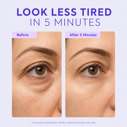 Instant Lift Eye Gel – Visibly Reduces Eye Bags, Puffiness & Dark Circles